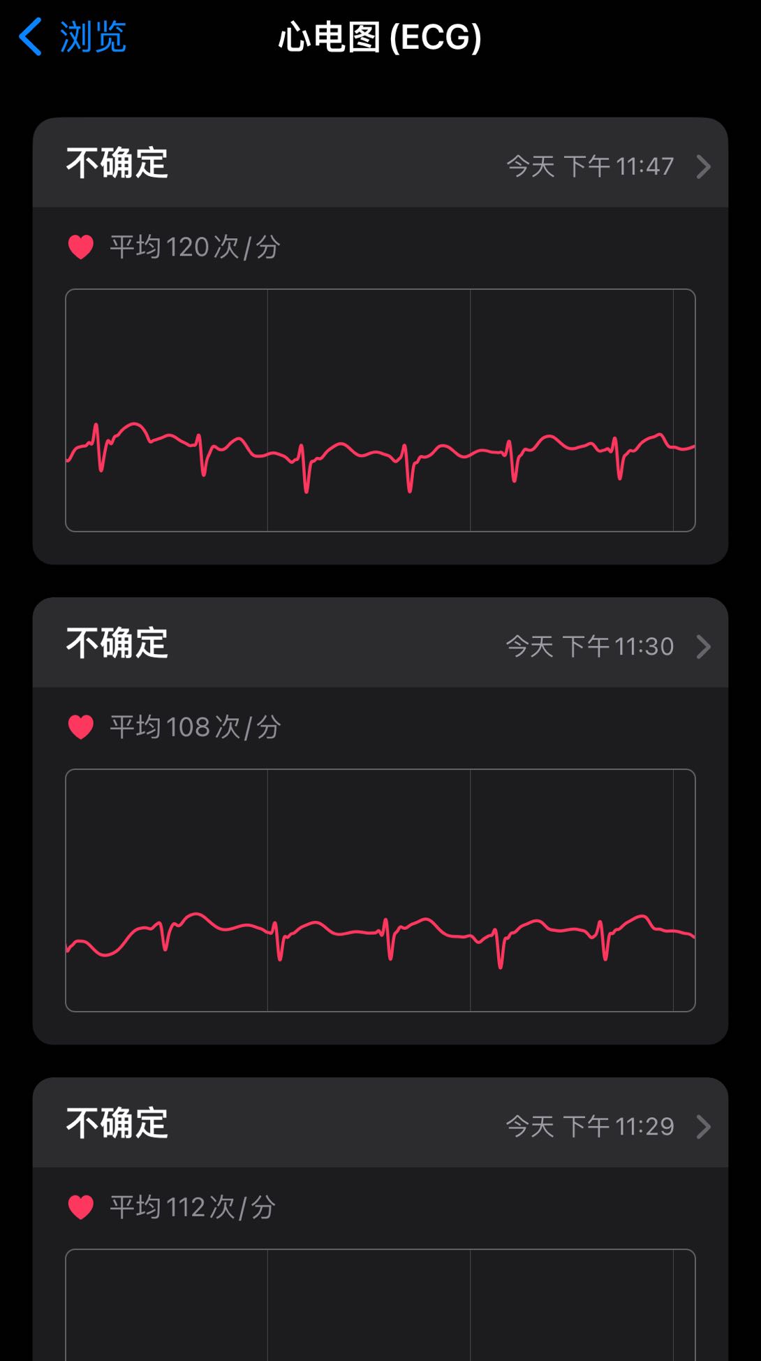 ECG